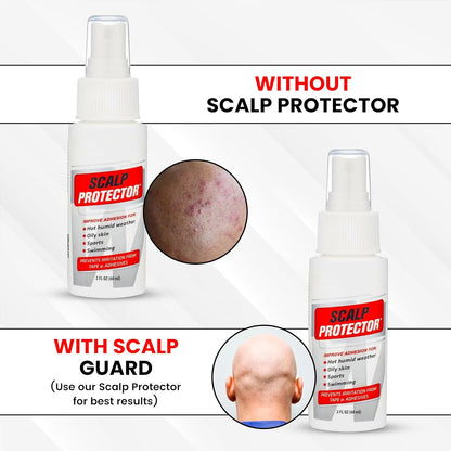 WalkerTape Scalp Protector Spray 60ml | Anti-itching and anti-bacterial | Improves adhesion and reduces itching| Skin- Friendly | Skin Protection &Adhesive Booster |